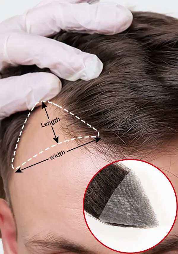 Front Hairline Patch (2 Pieces)